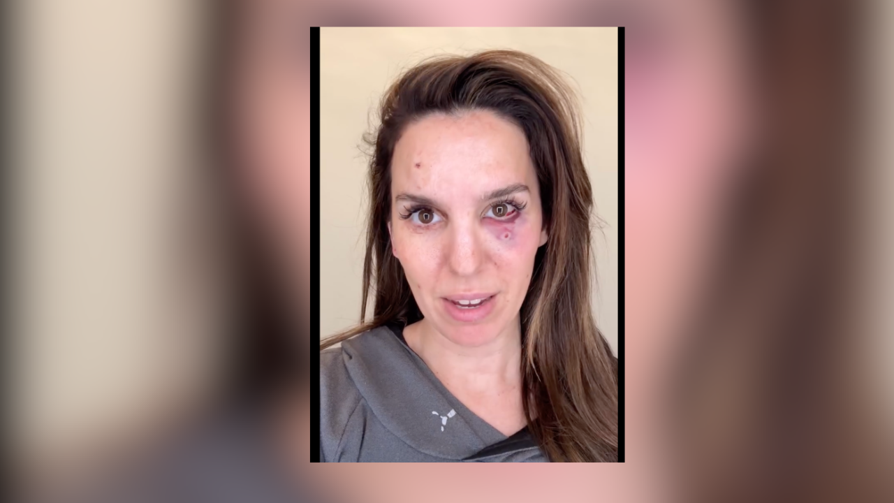 Kim's Possible Star Christy Carlson Romano shares gratitude after being shot Kim's Possible Star Christy Carlson Romano shares gratitude after being shot