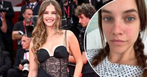 Venice Film Festival 2025: Barbara Palvin appears on the red carpet for the first time since endometriosis surgery